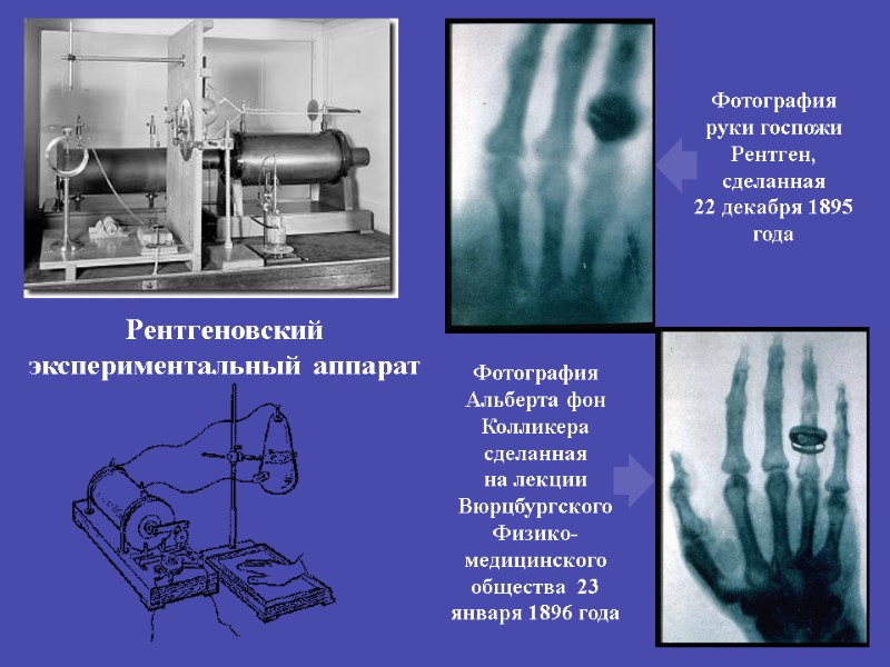 Рентгеновский экспериментальный аппарат Фотография руки госпожи Рентген, сделанная  22 декабря 1895 года Фотография